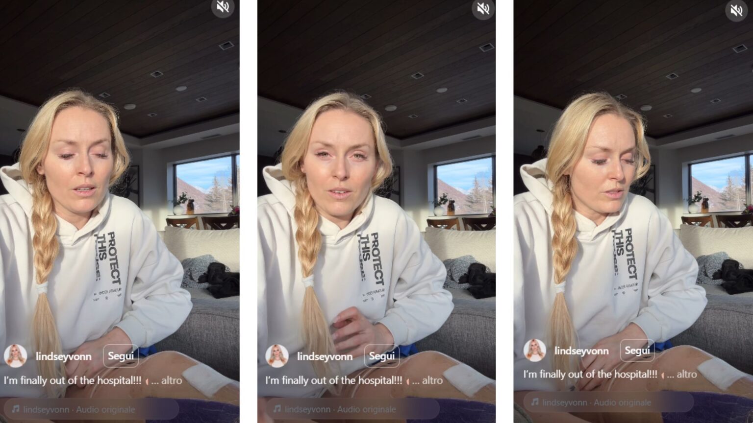 Lindsey Vonn racconta come ha rischiato di perdere la gamba alle Olimpiadi (i fan sono preoccupati) Lindsey Vonn ha rischiato l’amputazione della gamba