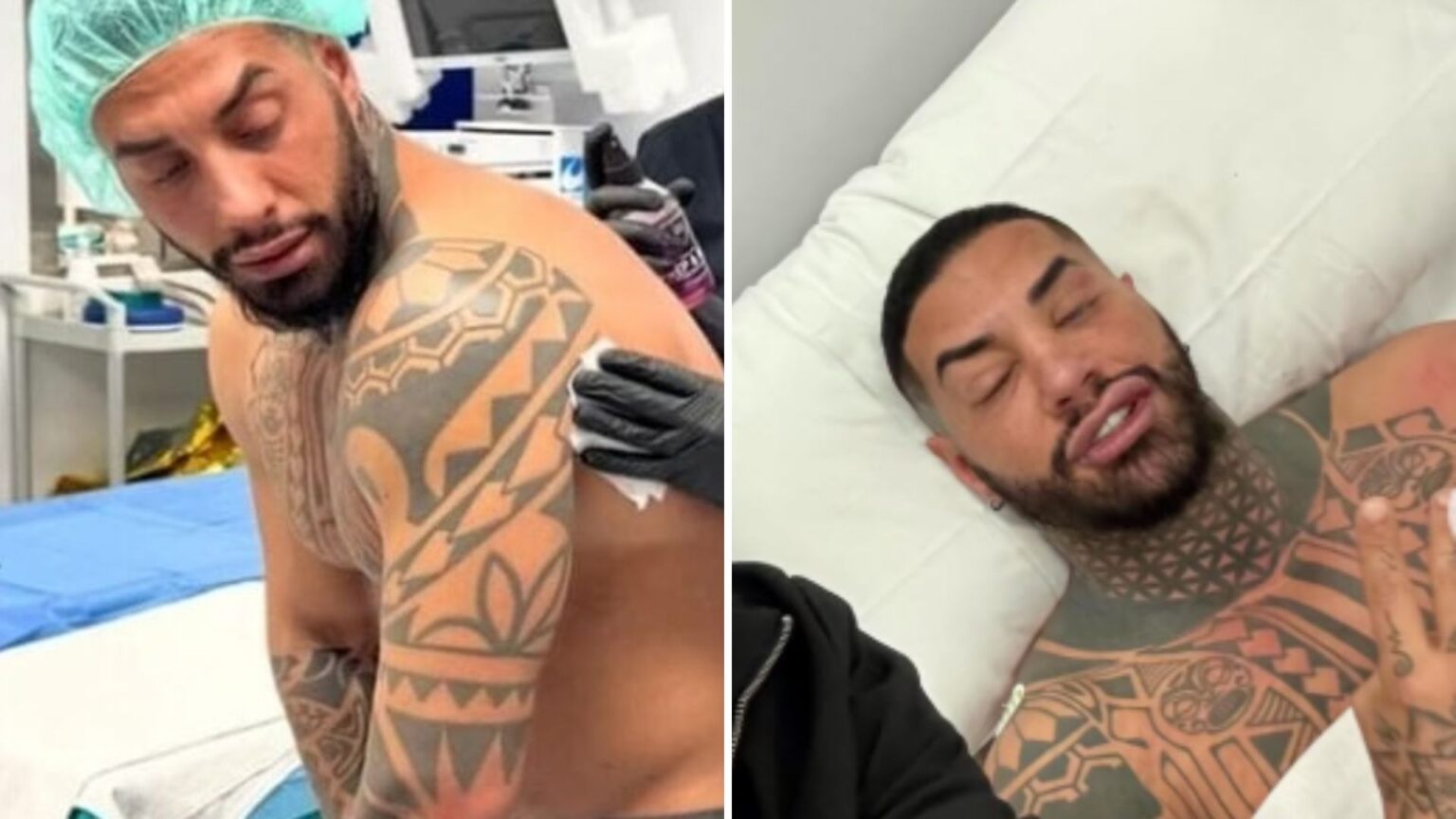 Francesco Chiofalo mentre affronta l'operazione per il tatuaggio istantaneo